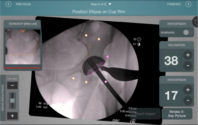 Demostraci�n Velys
